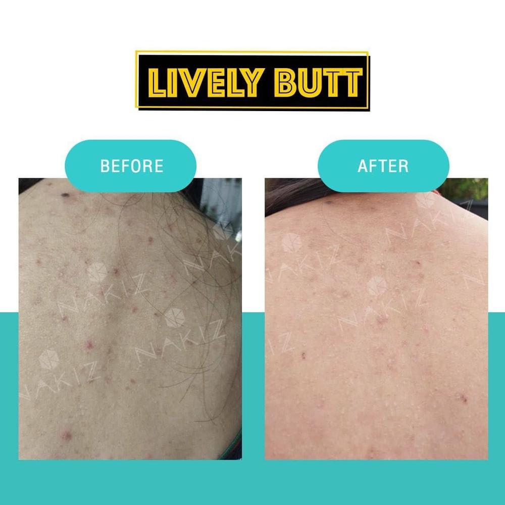 Nakiz Lively Butt Cream for Firming and Brightening Skin