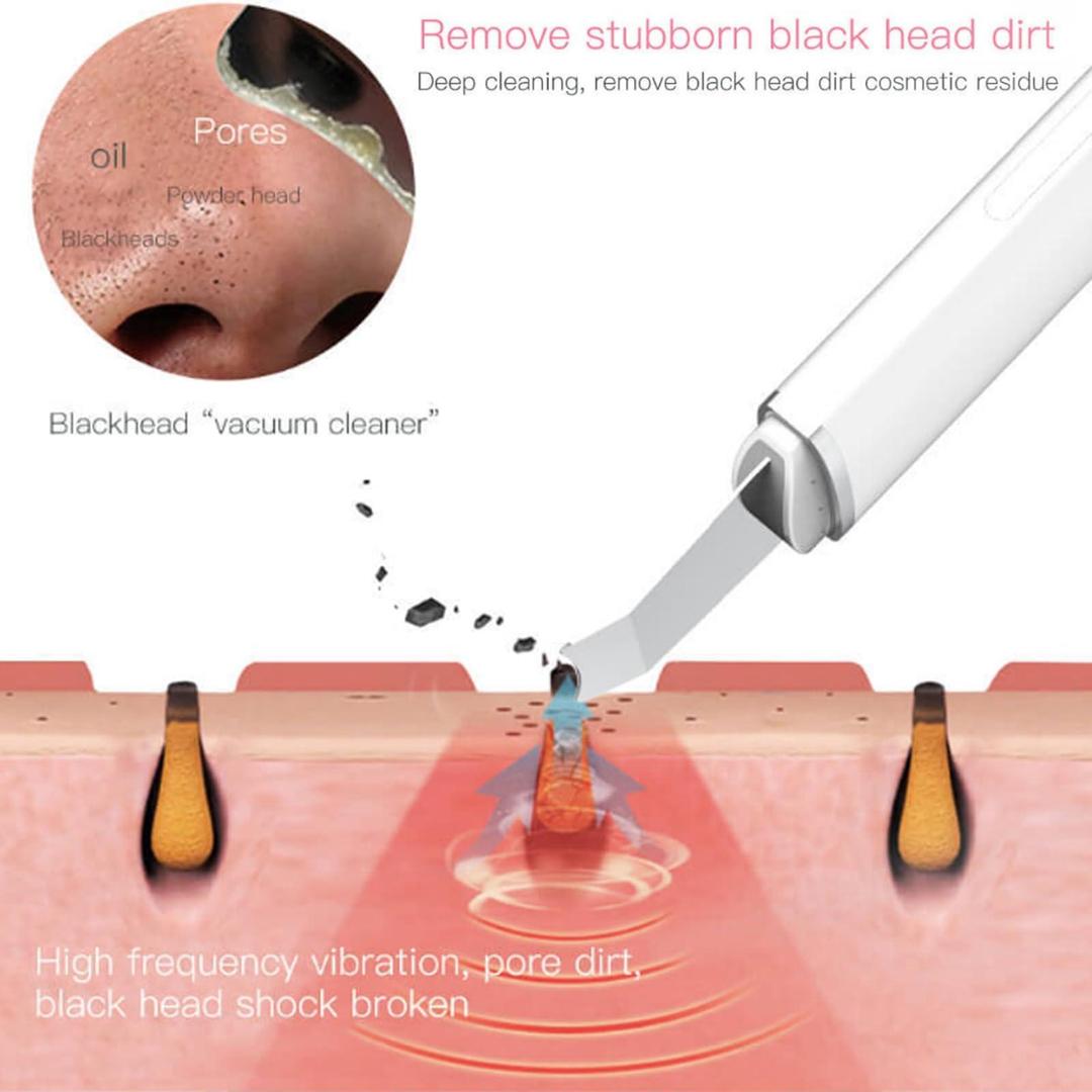 Face Blackhead Remover with Suction Technology for Smooth Skin